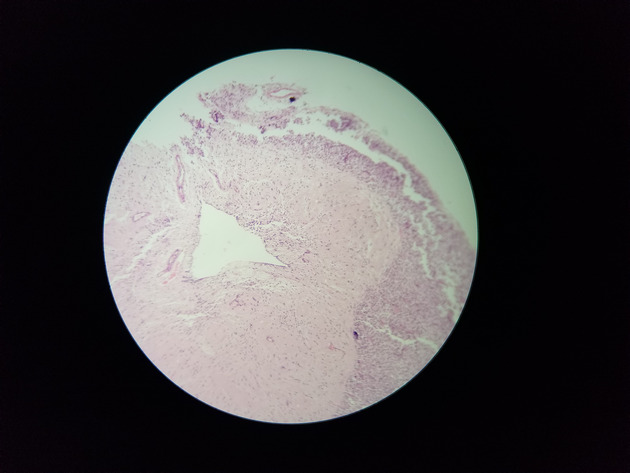 Pituitary Gland Slides - Pituitary Gland 006 100X